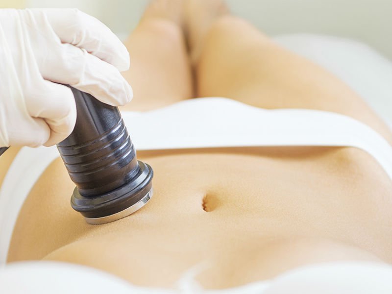 Qorinning ultratovushli liposuction